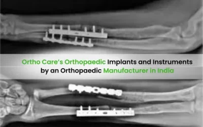 Ortho Care’s Orthopaedic Implants and Instruments by an Orthopaedic Manufacturer in India