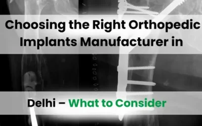 Choosing the Right Orthopedic Implants Manufacturer in Delhi – What to Consider