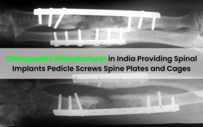 Orthopaedic Manufacturer in India Providing Spinal Implants Pedicle Screws Spine Plates and Cages