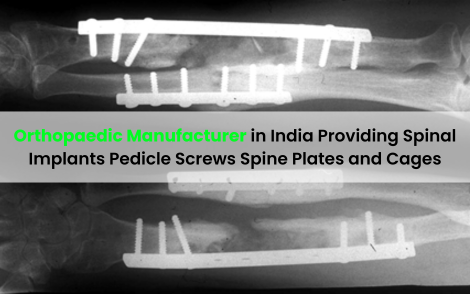 Orthopaedic Manufacturer in India Providing Spinal Implants Pedicle Screws Spine Plates and Cages