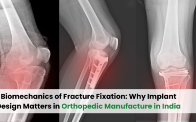 Biomechanics of Fracture Fixation: Why Implant Design Matters in Orthopedic Manufacture in India