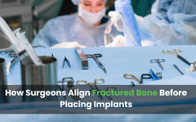 How Surgeons Align Fractured Bone Before Placing Implants