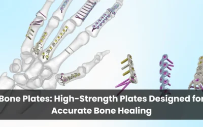 Bone Plates: High-Strength Plates Designed for Accurate Bone Healing