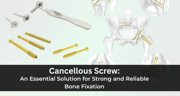 Cancellous screw for orthopedic fracture fixation surgery
