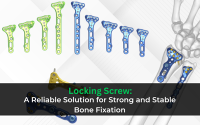Locking Screw: A Reliable Solution for Strong and Stable Bone Fixation