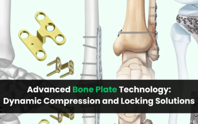 Advanced Bone Plate Technology: Dynamic Compression and Locking Solutions