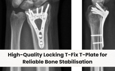 High-Quality Locking T-Fix T-Plate for Reliable Bone Stabilisation