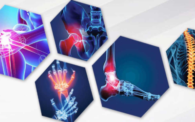 5 Innovations Shaping Modern Orthopedic Care: From Trauma to Recovery