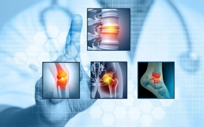 Choosing the Right Orthopedic Implants Manufacturer in India: Quality, Certification, and Trust
