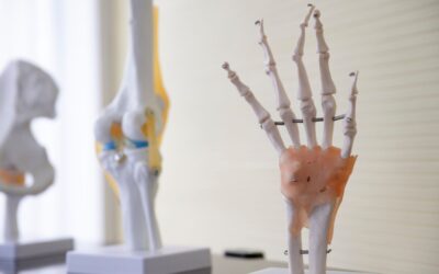 Role of Steinmann Pins in Managing Complex Bone Fractures